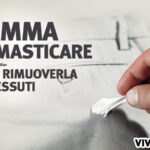 come togliere la gomma da masticare dai pantaloni